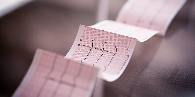 Gráfico de um eletrocardiograma que mostra a atividade elétrica do coração.